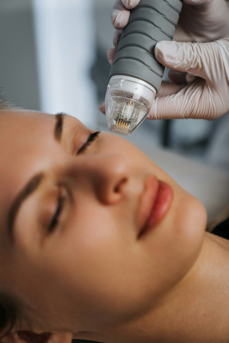 Microneedling Behandlungen